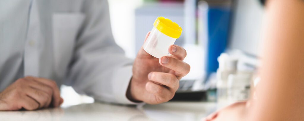 how to implement an employee drug screening program